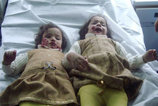 Victims of explosion in Iraq 